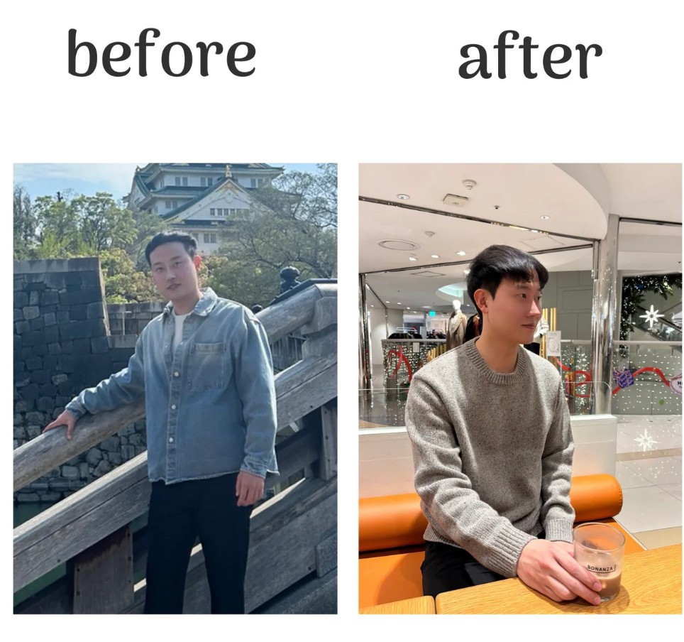 고객 Before/After 3