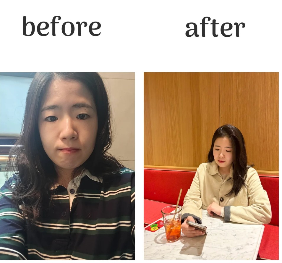 고객 Before/After 6